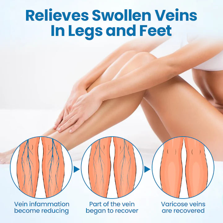 NESLEMY® VeinGuard Herbal Spray-✅ Clinically proven to eliminate varicose veins in just 7 days!